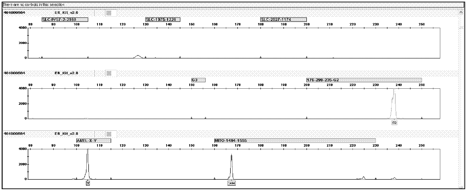 High-specificity kit for detecting deafness predisposing genes