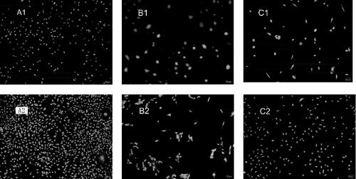 Preparation method of HAP/PLA composition bone repair stent loaded with strontium ranelate