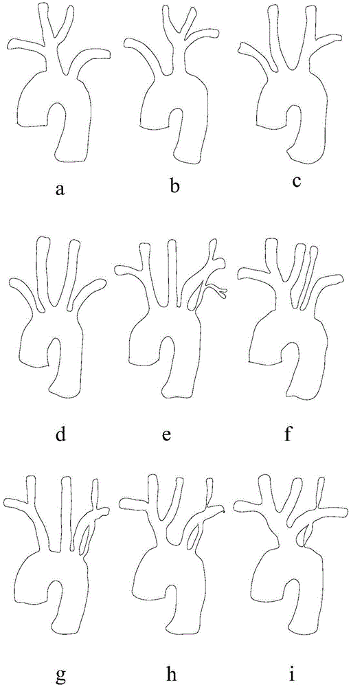 Multi-channel membrane-coated intravascular stent and preparation method thereof