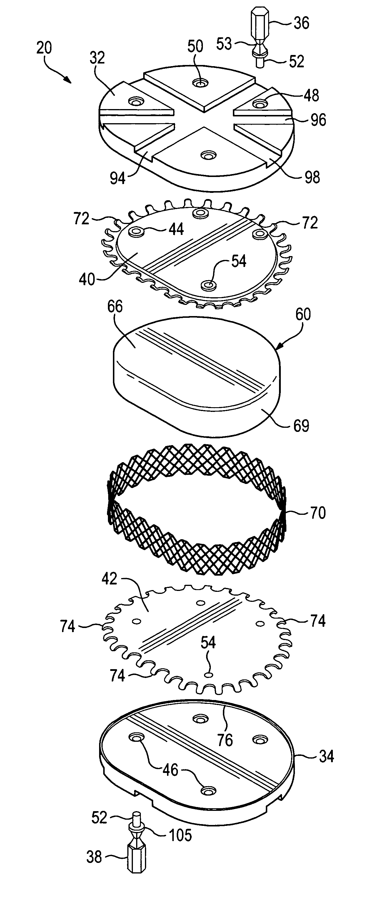 Anatomic total disc replacement