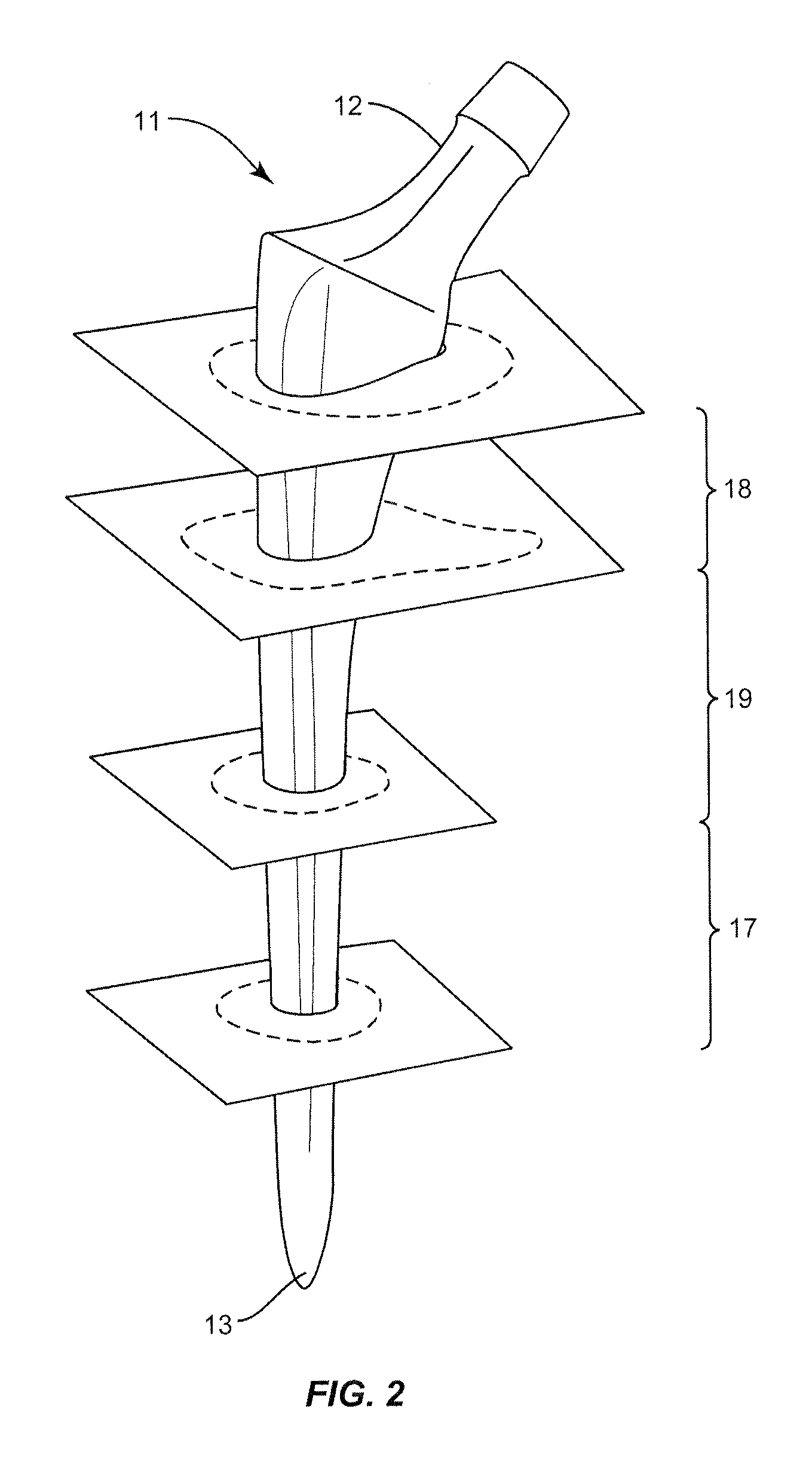 Methods and Devices for a Surgical Hip Replacement Procedure