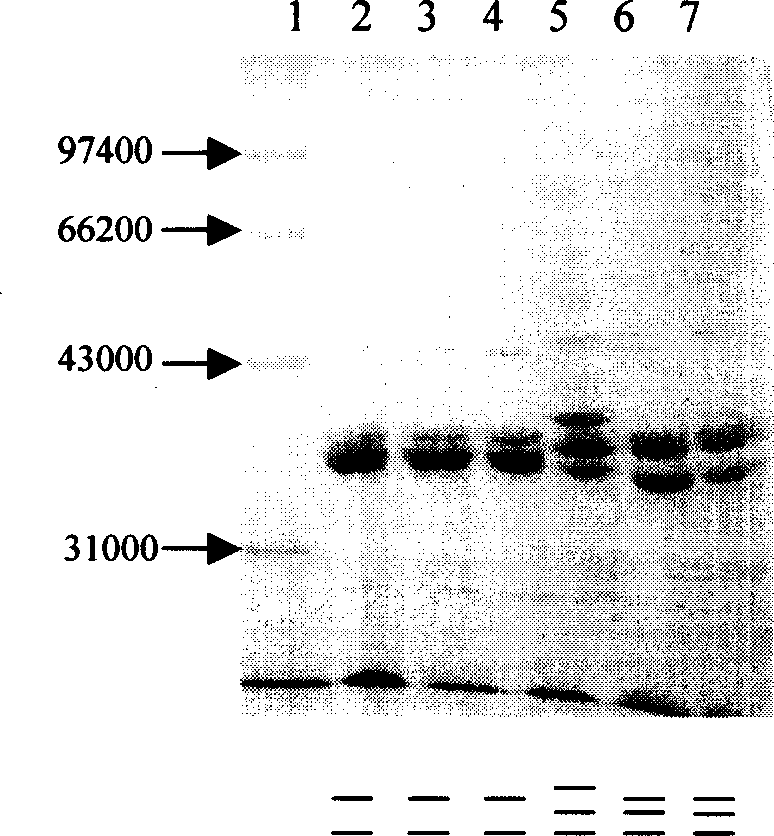 Chicken escherichia coli heterotype outer membrane protein cell engineered bacterial strain preparing method