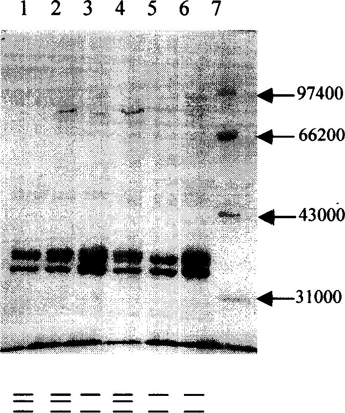 Chicken escherichia coli heterotype outer membrane protein cell engineered bacterial strain preparing method