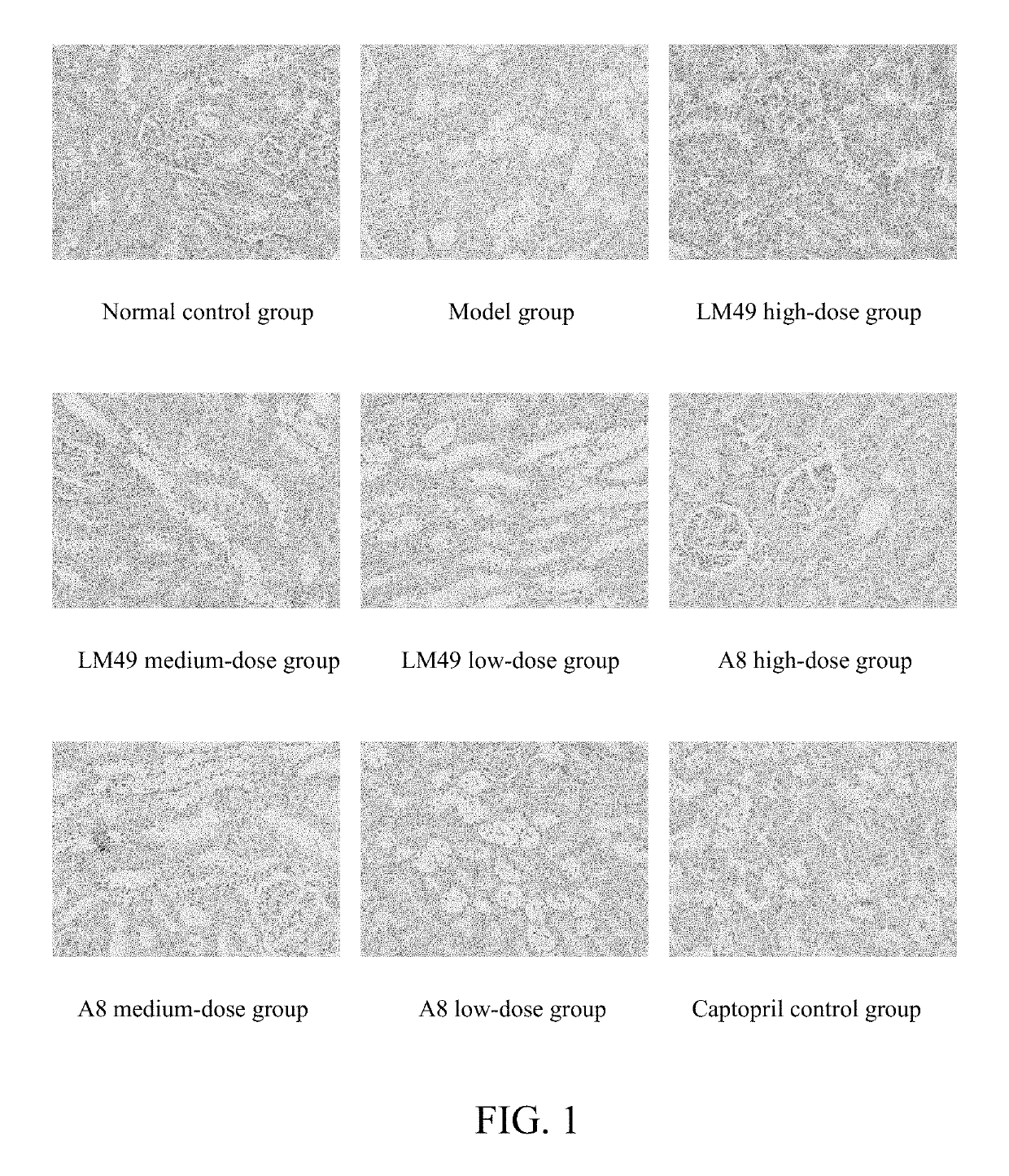 Applications of benzophenones in preparation of drug