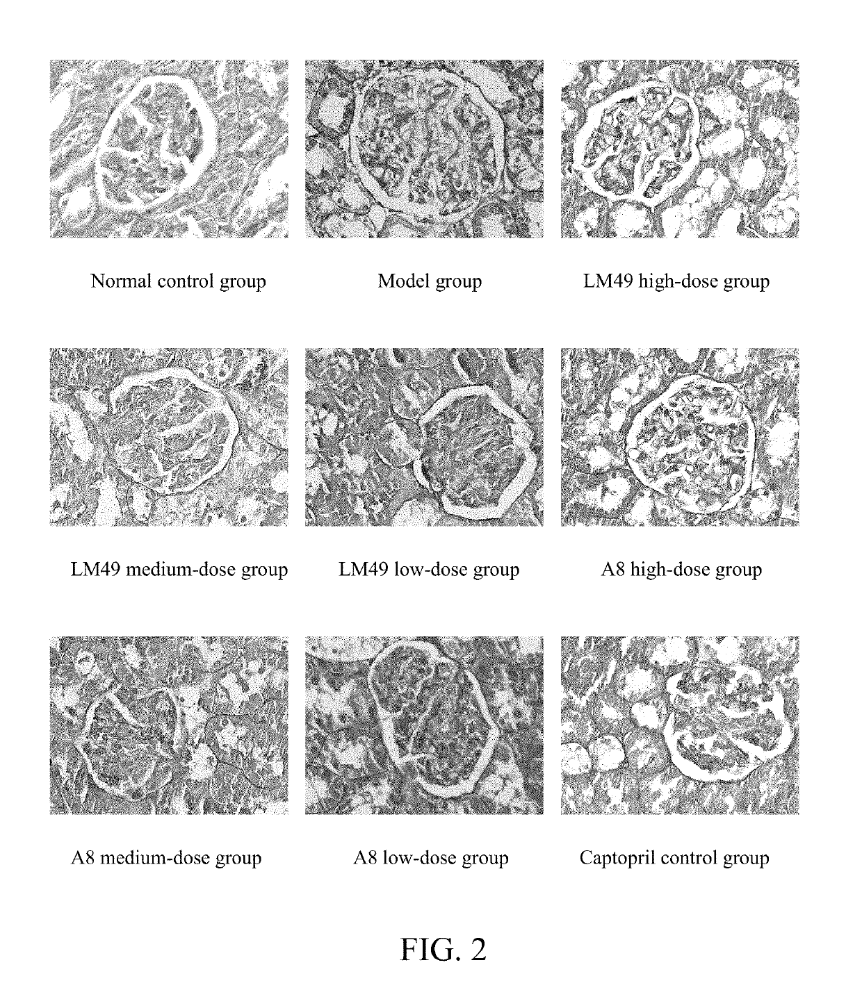 Applications of benzophenones in preparation of drug