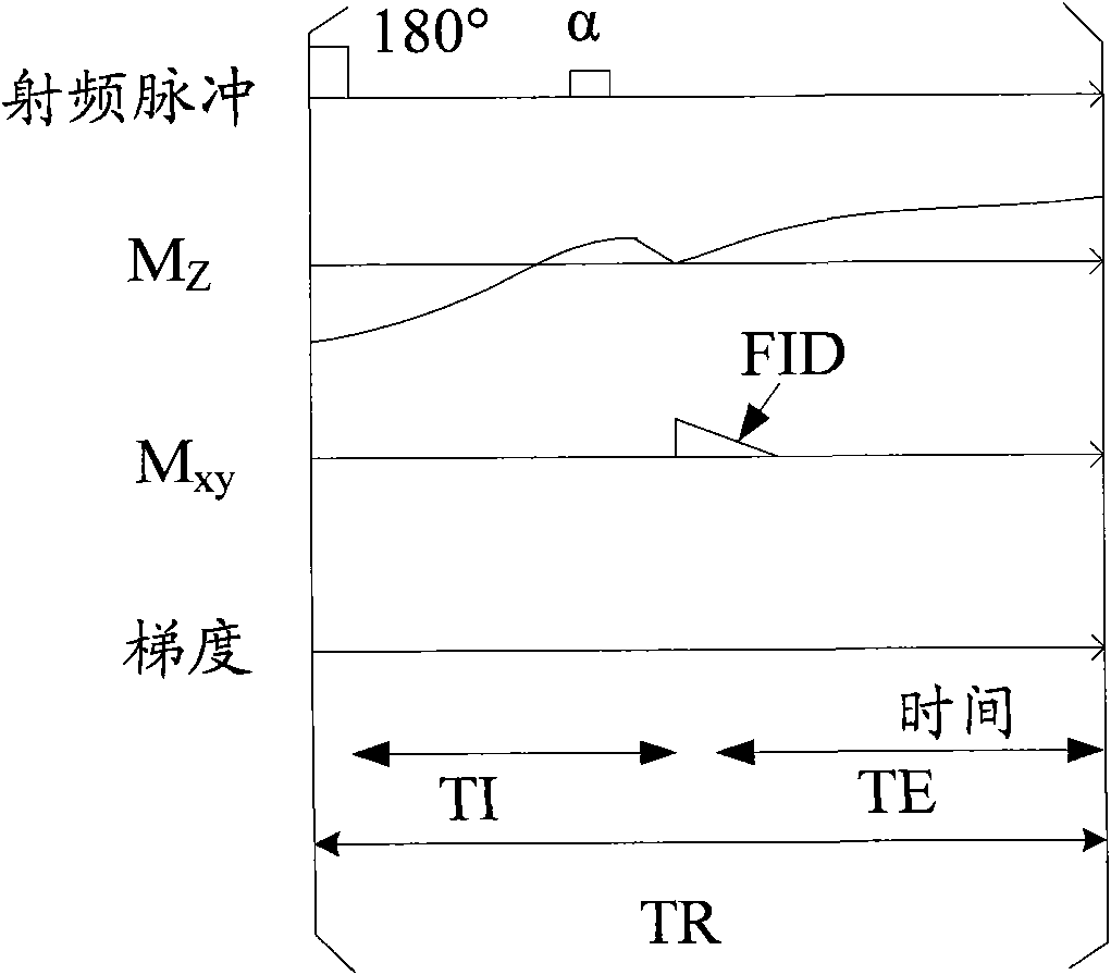 Method and system for calculating quantitative parameter of magnetic resonance imaging