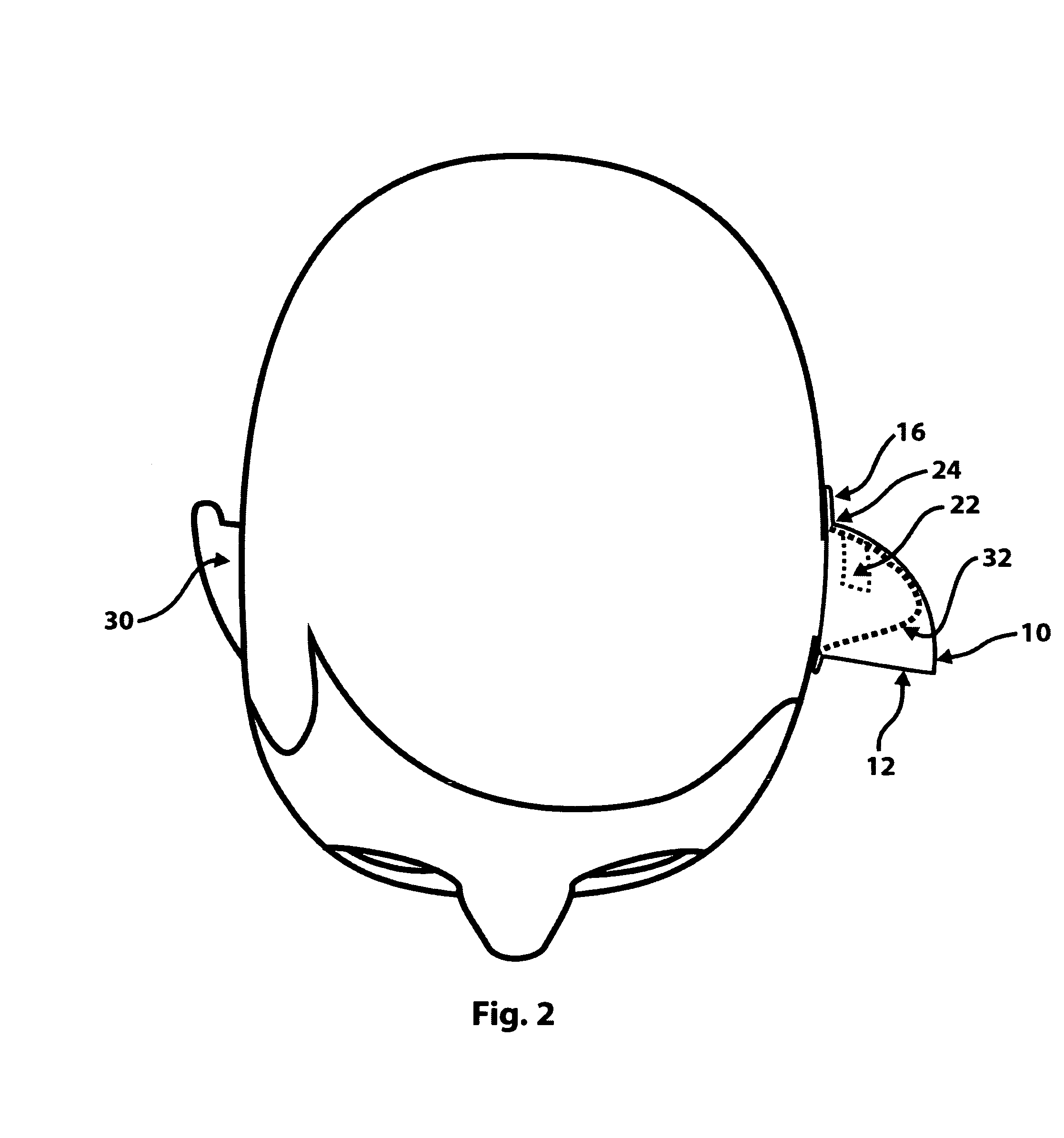 Ear-mounted lenticular acoustic reflector