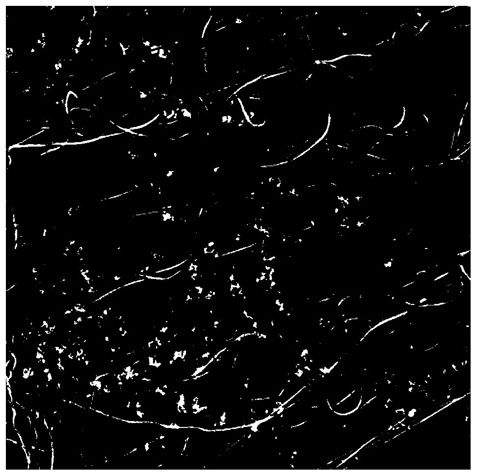 Microballons/nanometer yarn composite bracket loaded with exosomes and growth factors and preparation method of microballons/nanometer yarn composite bracket