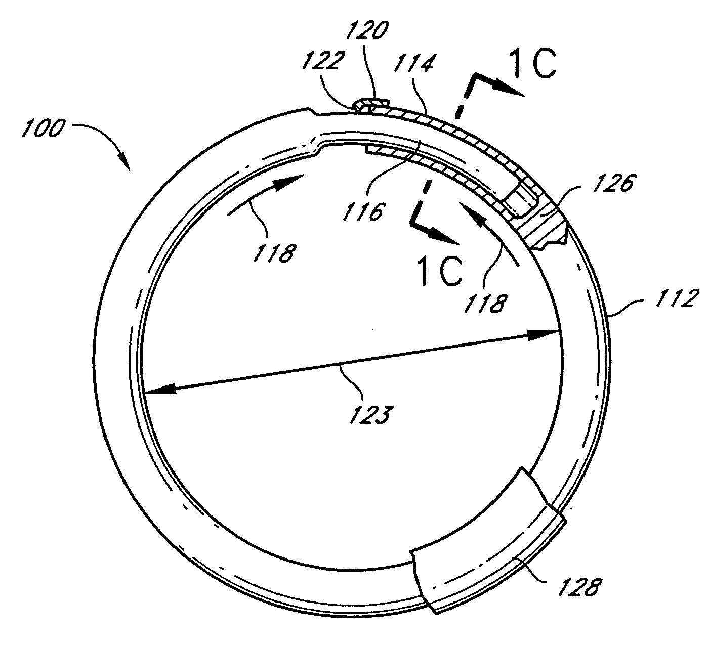 Adjustable cardiac valve implant with selective dimensional adjustment