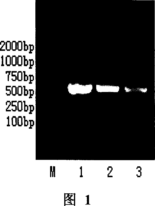 Method for preparing mutant code cDNA of apoptosis induction ligand related to human tumor necrosis factor, and application