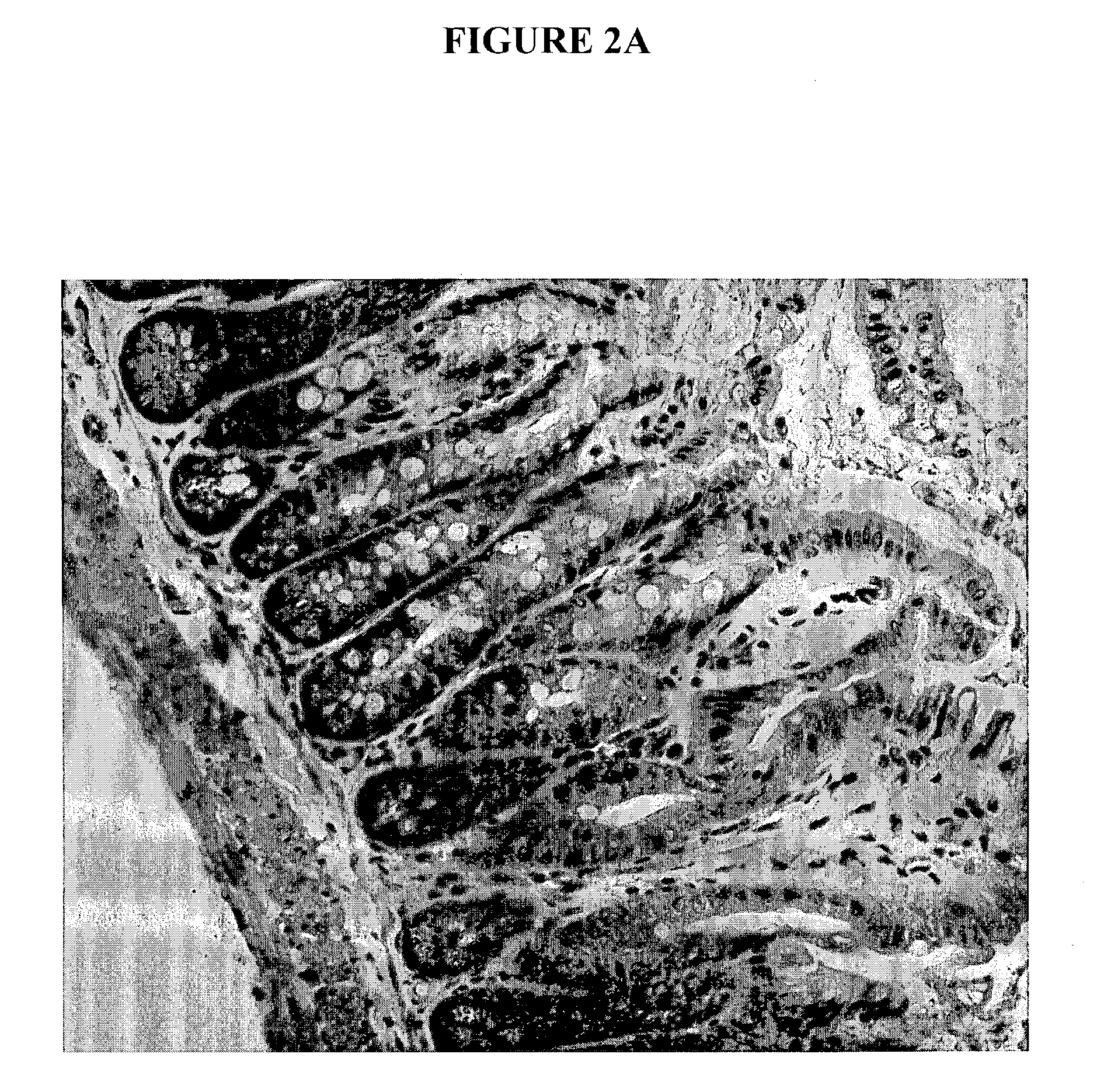 Compositions and methods related to graft-versus-host disease