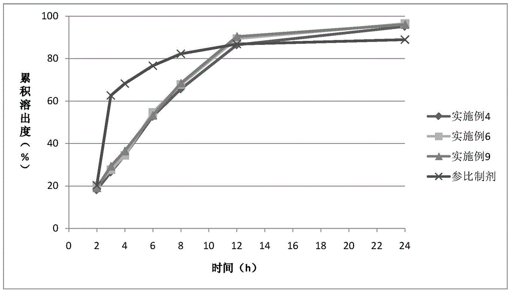 Trospium chloride slow-release composition and preparation method thereof