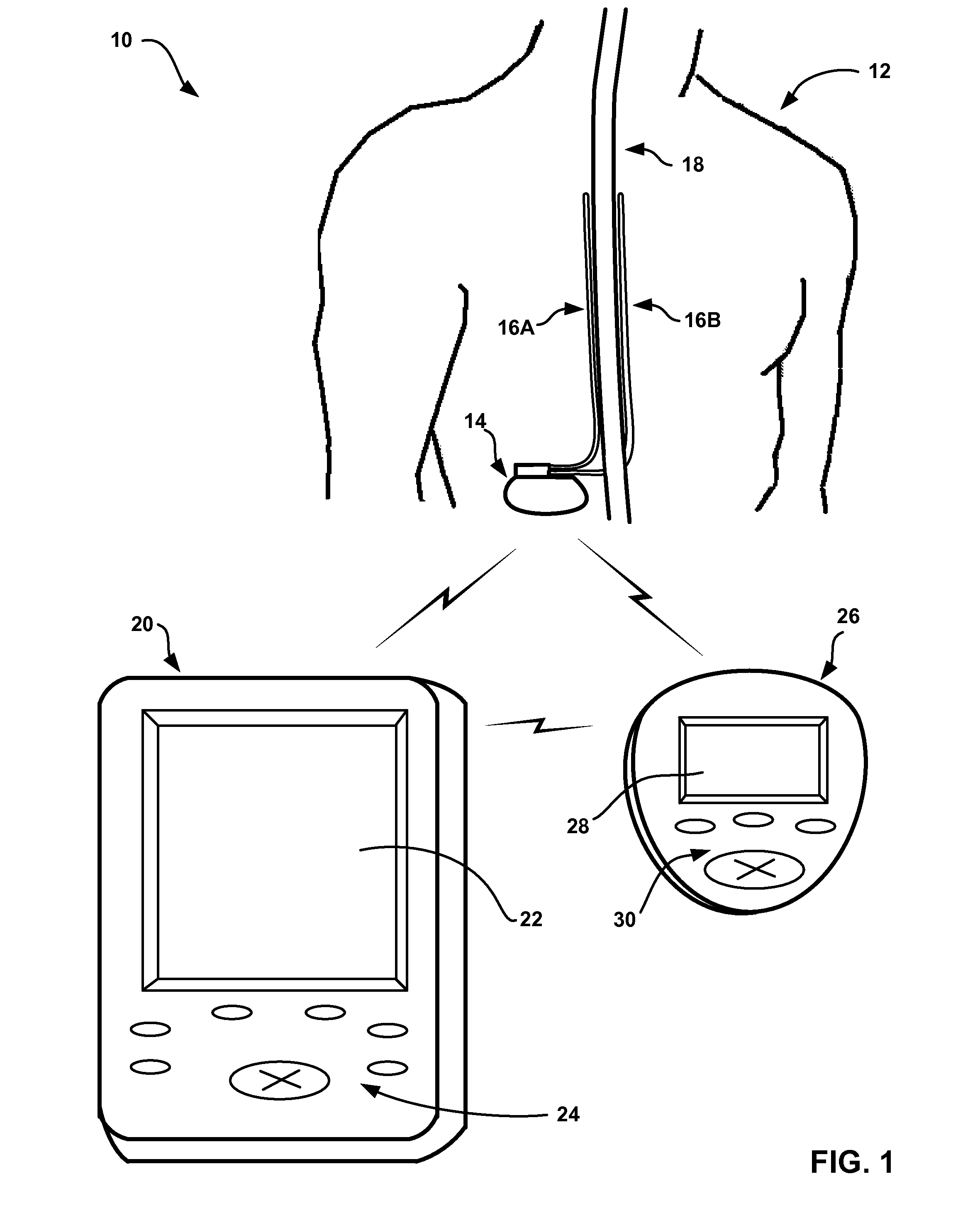 Neurostimulation therapy usage diagnostics