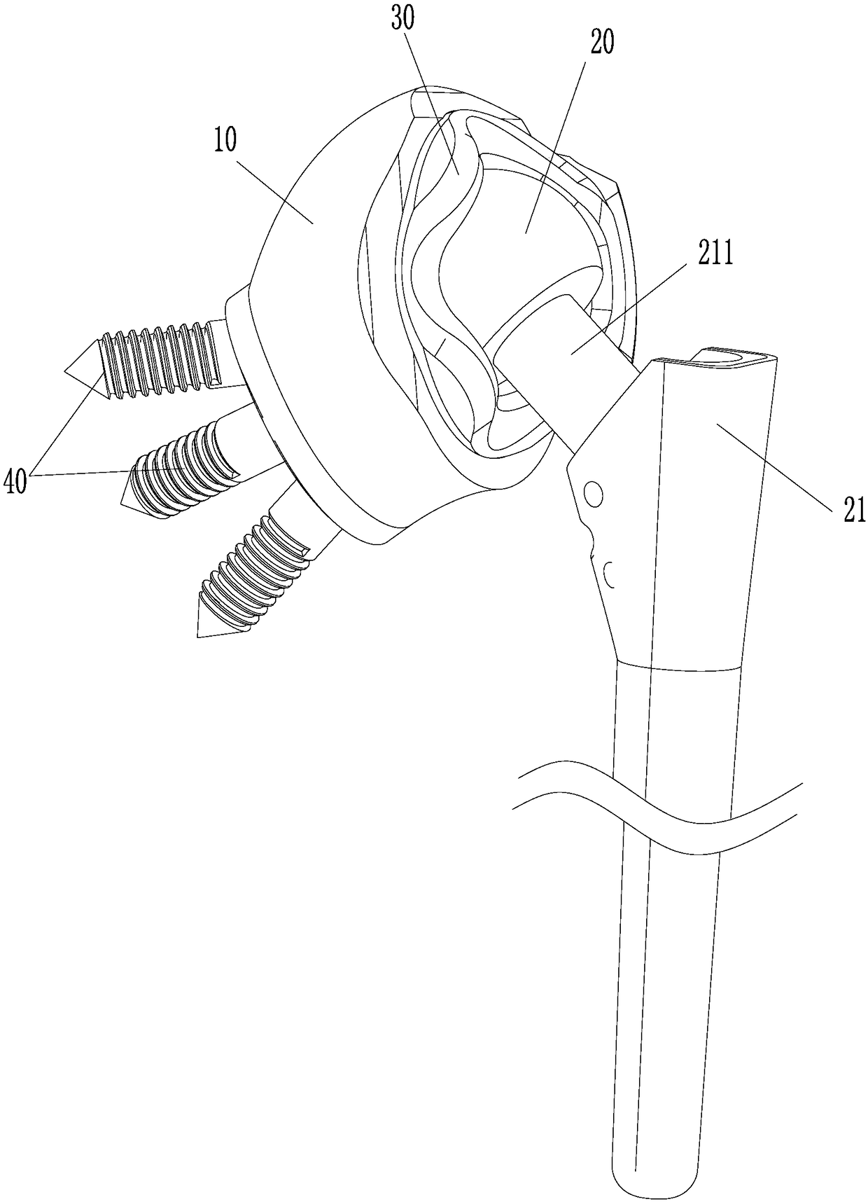 Shoulder joint prosthesis