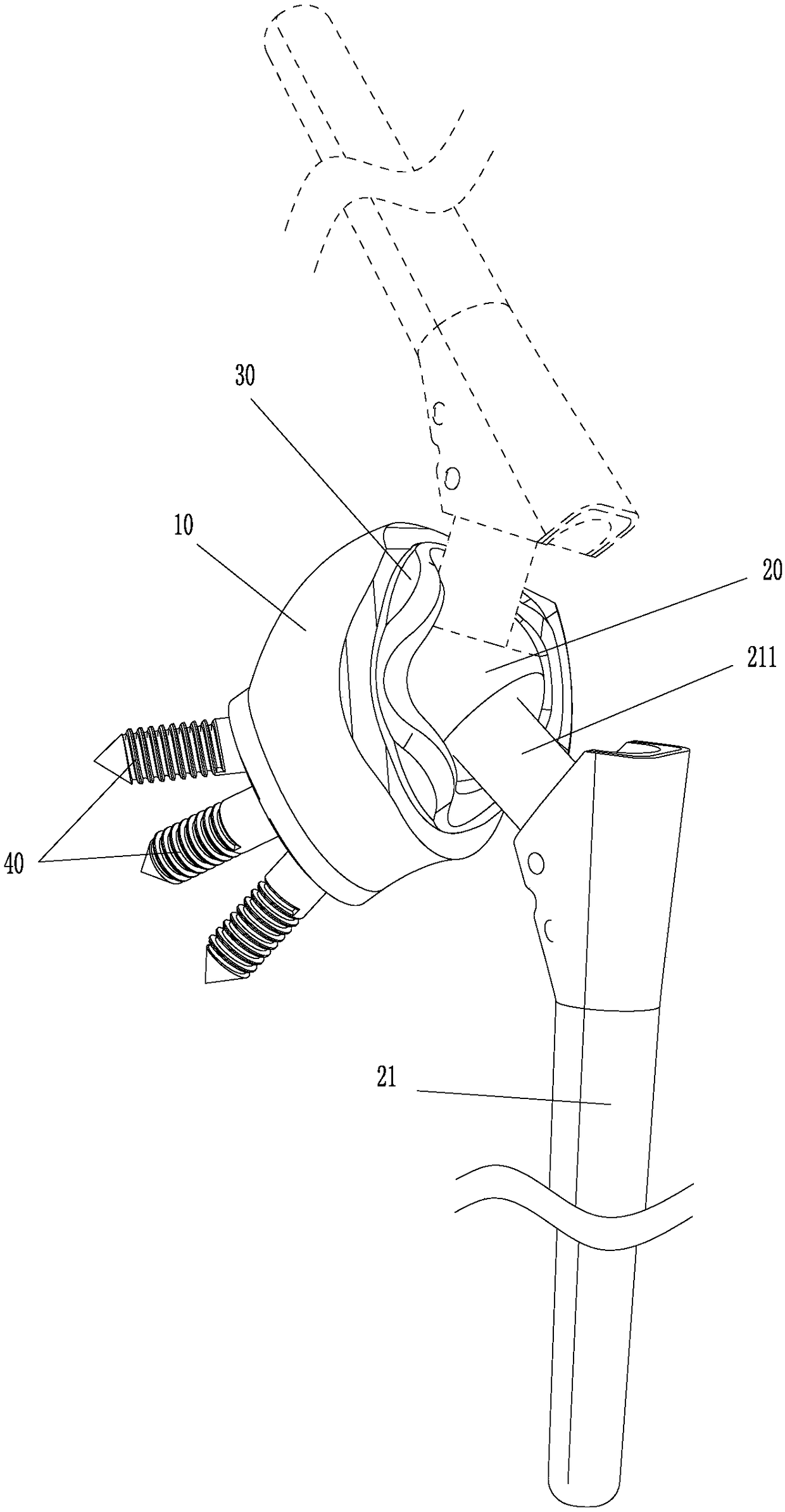 Shoulder joint prosthesis