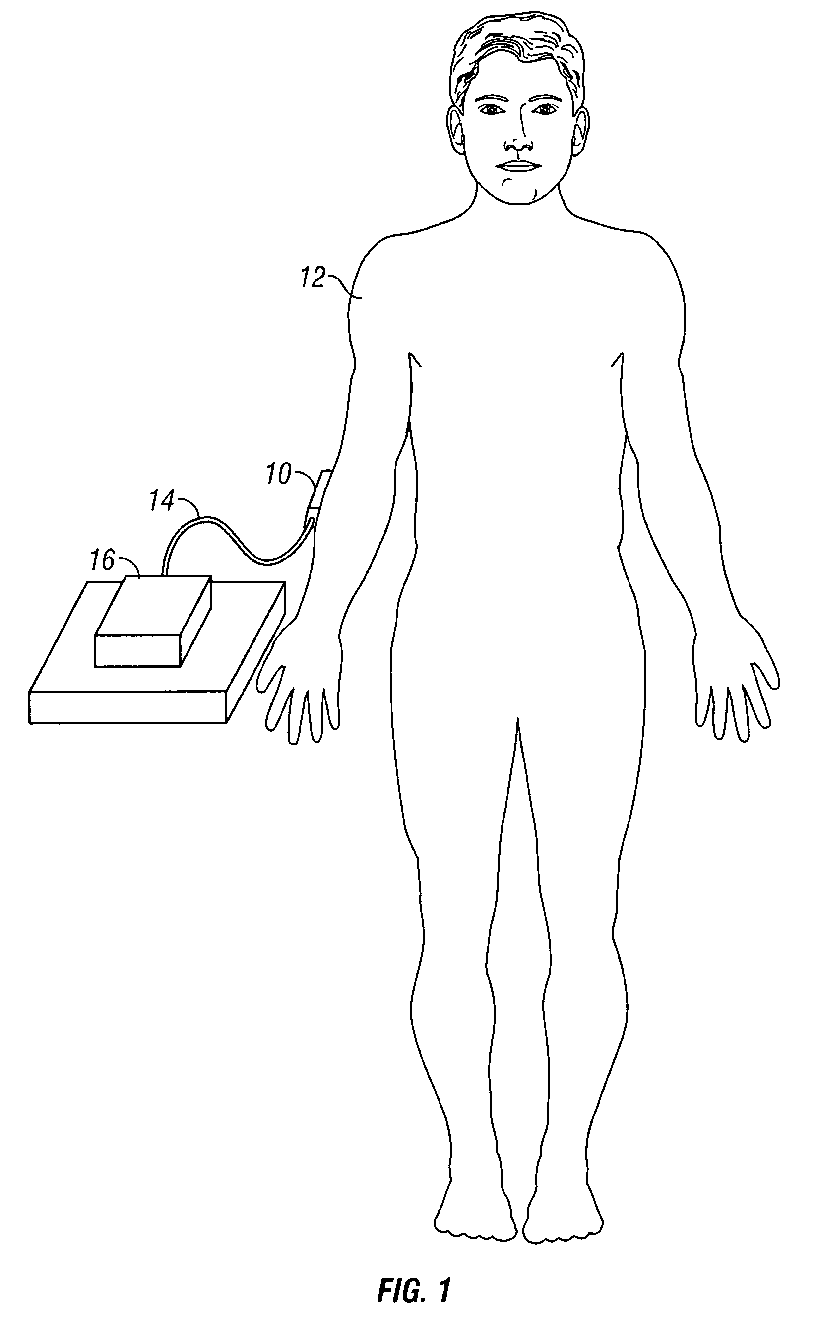 Compact apparatus for noninvasive measurement of glucose through near-infrared spectroscopy