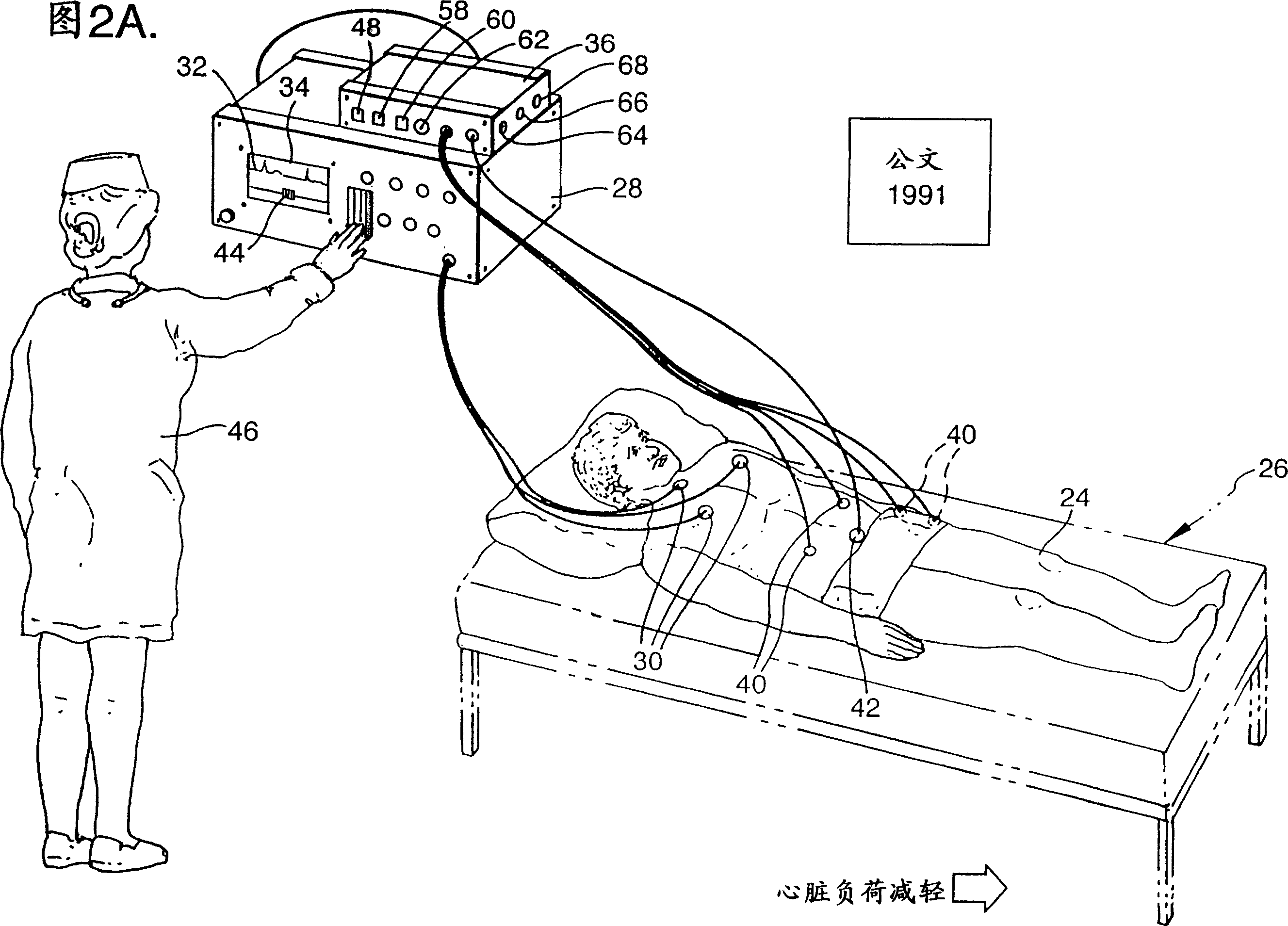 Method of treating a living organism to achieve a heart load reduction, and apparatus for carrying out the method