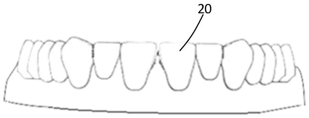 Manufacturing method of tooth beautifying braces