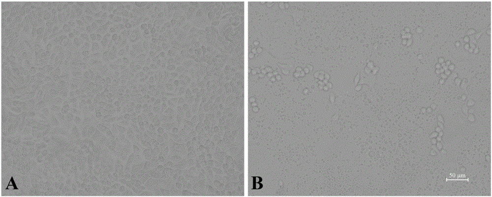 Attenuated strain YN150 of variant porcine epidemic diarrhea virus and applications thereof