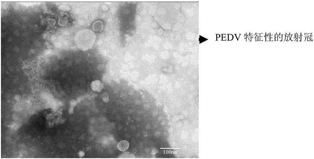 Attenuated strain YN150 of variant porcine epidemic diarrhea virus and applications thereof