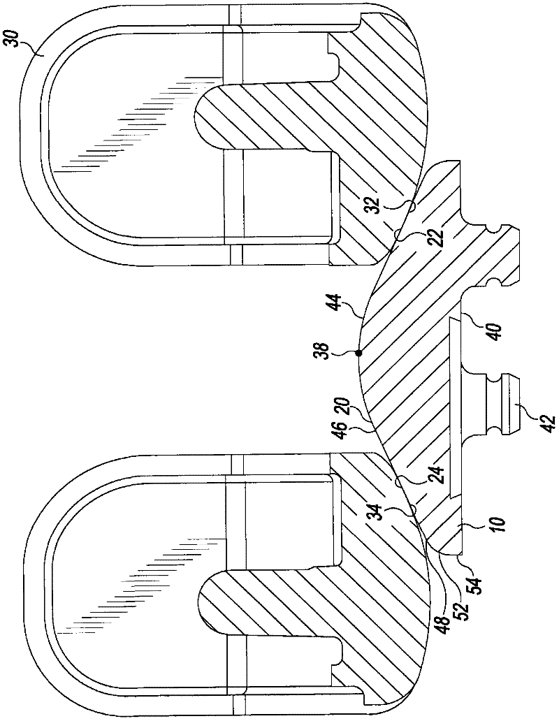 Knee prosthesis having commonly-sized patella components with varying thicknesses and peak surface diameters