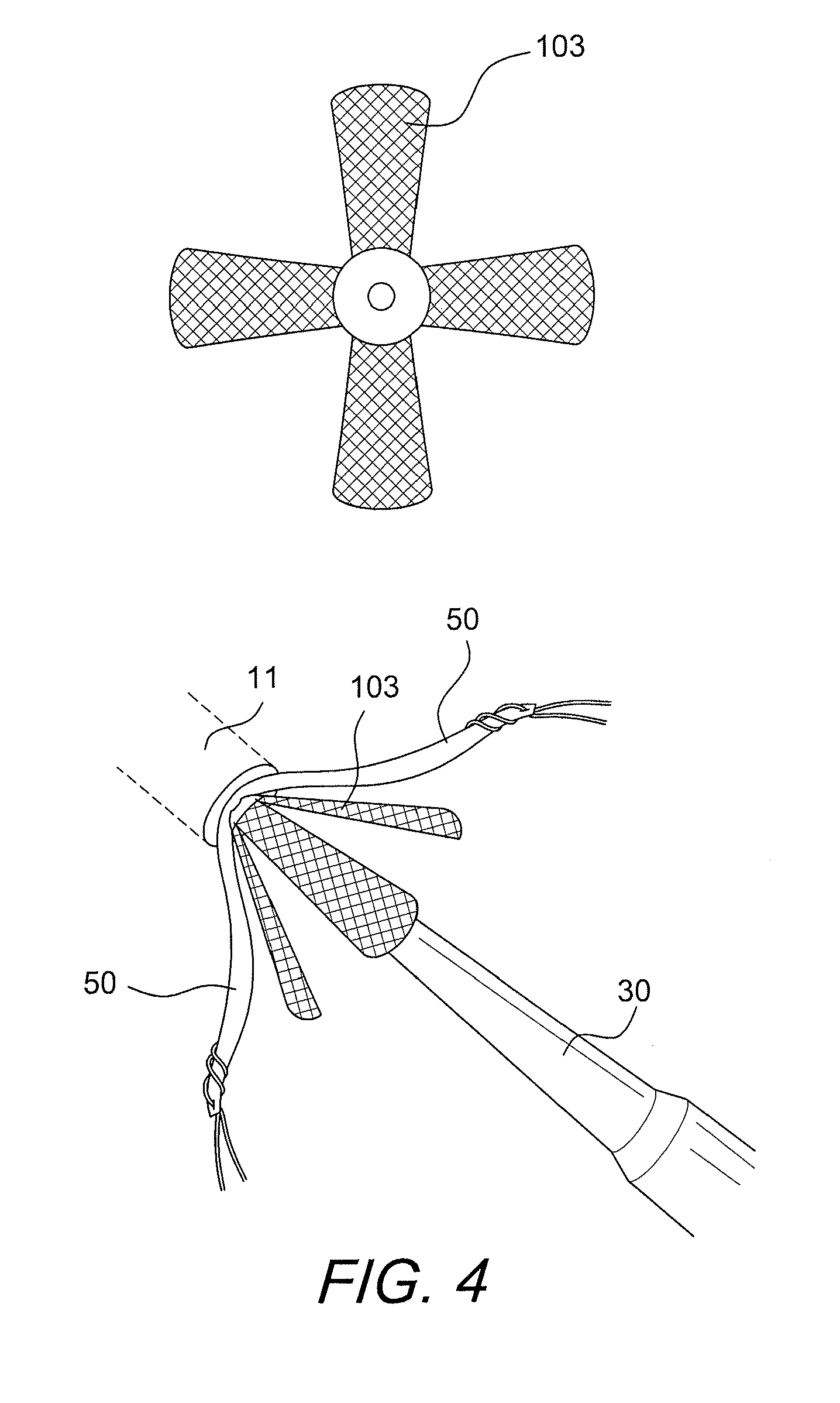 Graft protection mesh and fixation technique