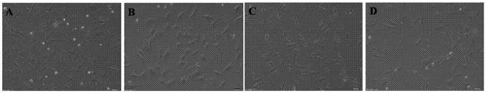 Mesenchymal stem cell factor composition as well as preparation method and application thereof