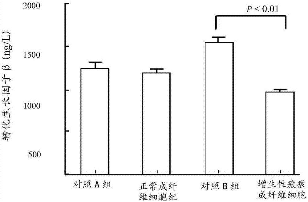 Mesenchymal stem cell factor composition as well as preparation method and application thereof