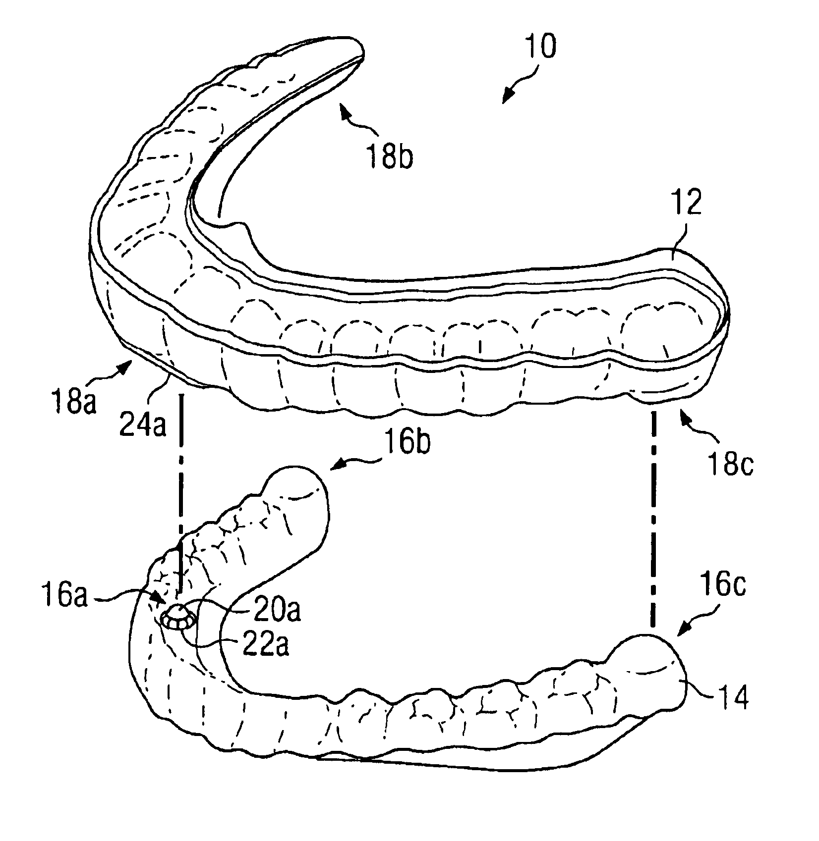 Oral appliance for maintaining stability of one or more aspects of a user's masticatory system