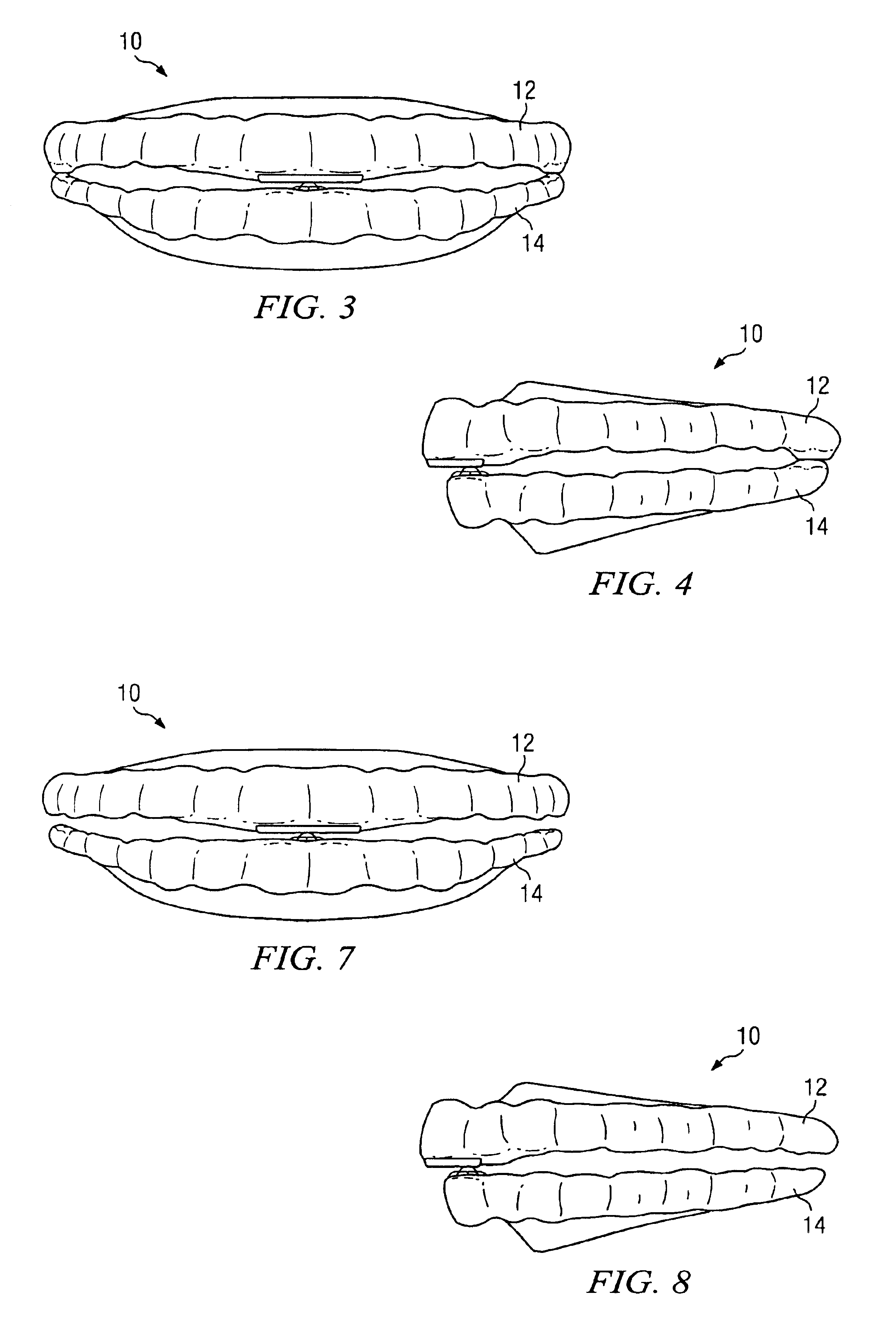 Oral appliance for maintaining stability of one or more aspects of a user's masticatory system