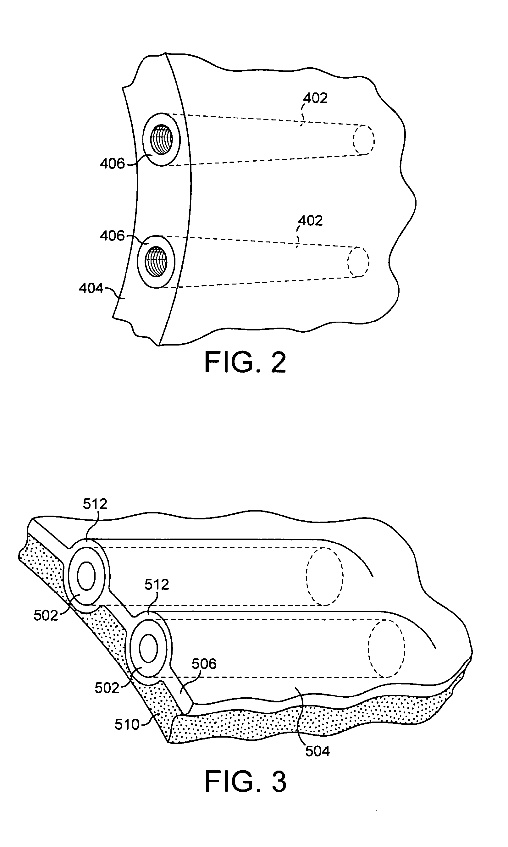 Wind or tidal turbine blade having an attachment