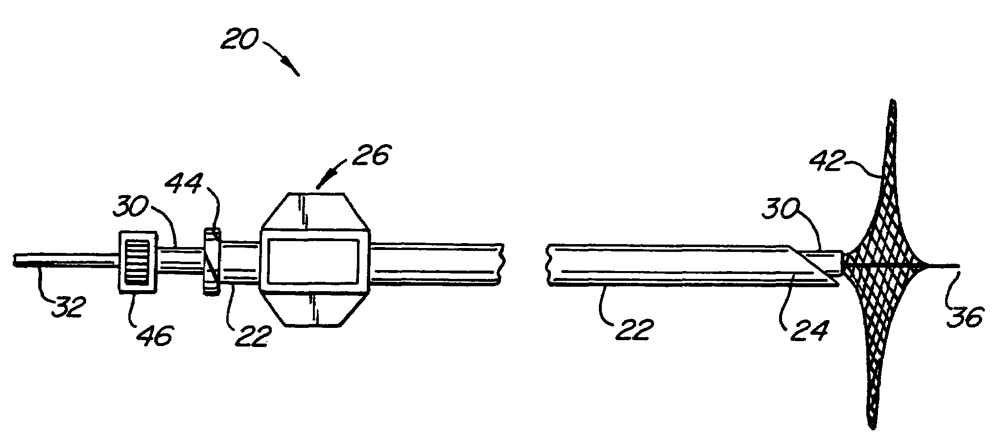 Target tissue localization device