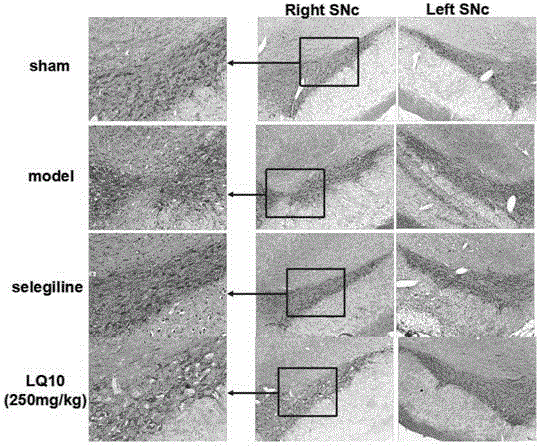 Preparation of fructus forsythiae active site and application of fructus forsythiae active site to Parkinson disease