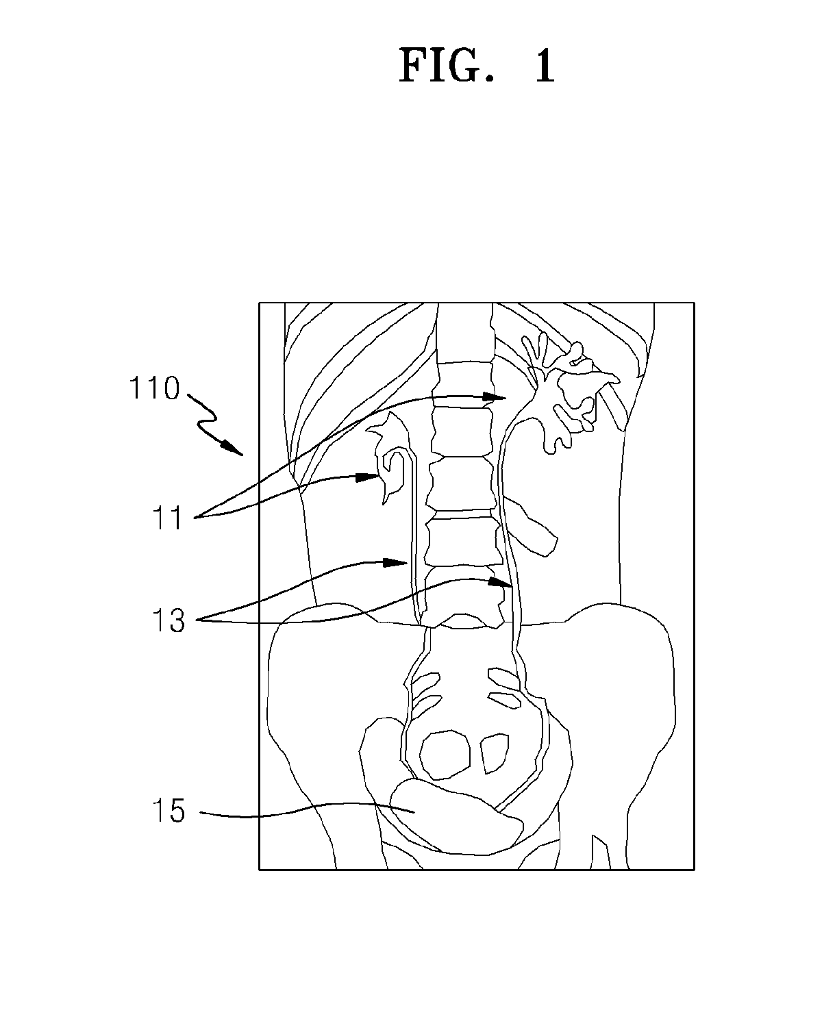 Method and apparatus for obtaining x-ray image of region of interest of object