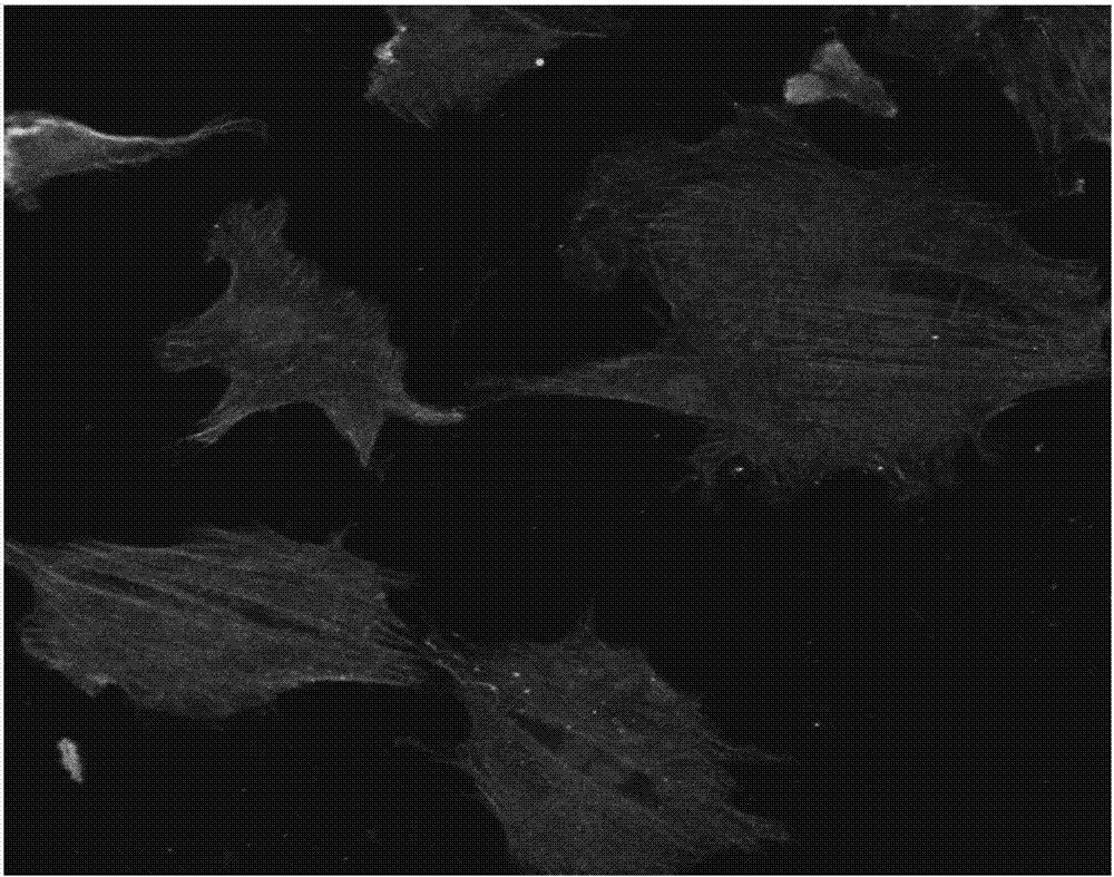 Application of BK channel opener in establishing vascular smooth muscle cell calcification model