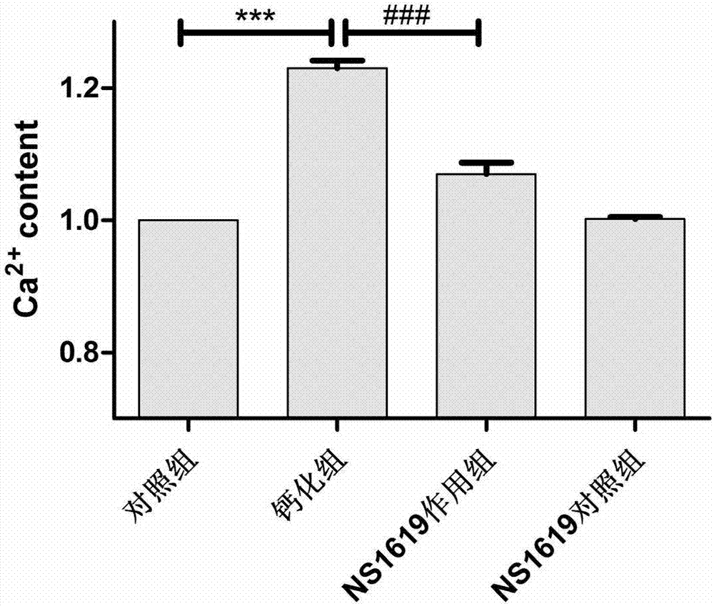 Application of BK channel opener in establishing vascular smooth muscle cell calcification model