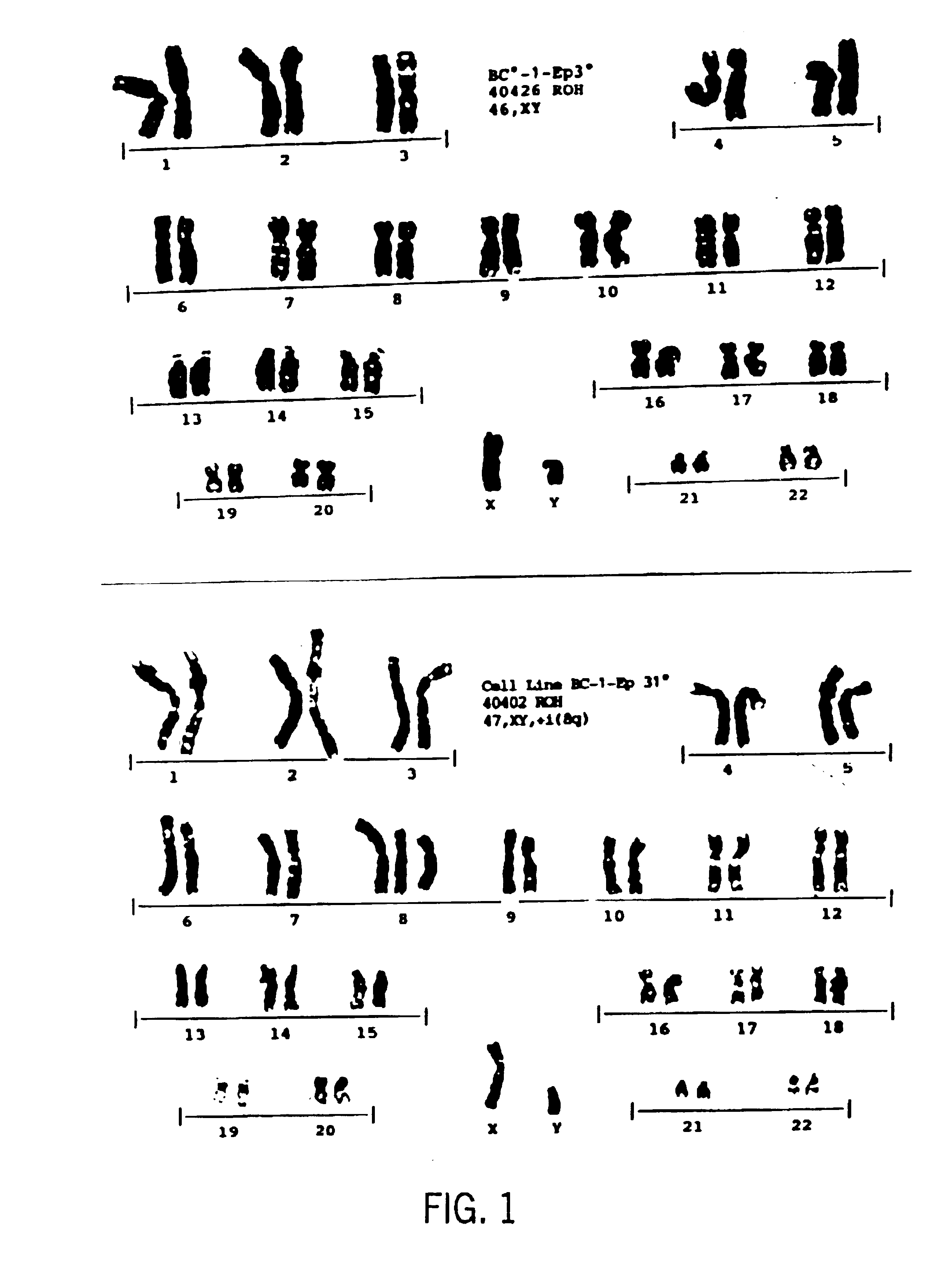 Immortalized human keratinocyte cell line