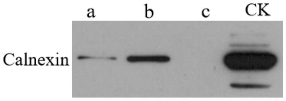 Separation and enrichment method for quickly extracting tissue extracellular vesicles