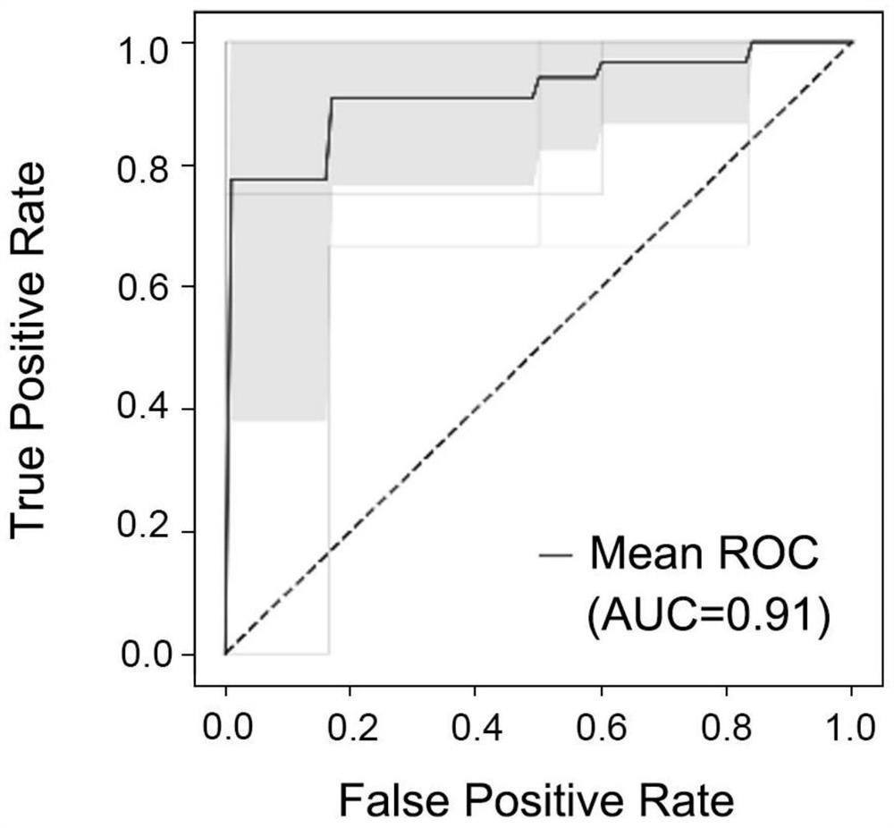 Application of peripheral blood exosome miRNA combined marker to preparation of kit for detecting HBV positive liver cirrhosis early liver cancer