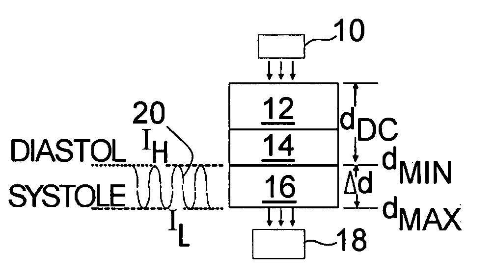 Pulse oximeter based techniques for controlling anesthesia levels and ventilation levels in subjects