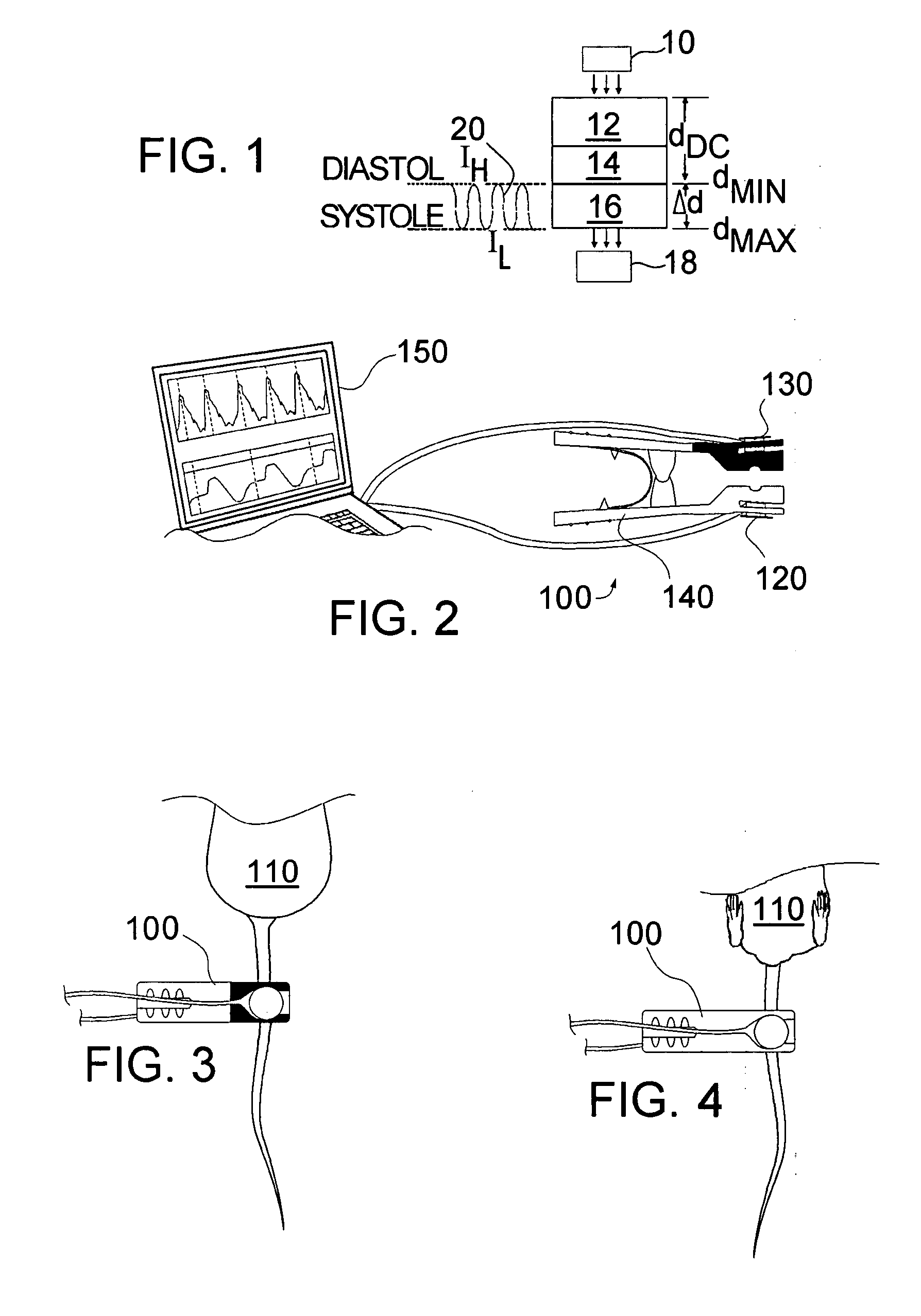 Pulse oximeter based techniques for controlling anesthesia levels and ventilation levels in subjects