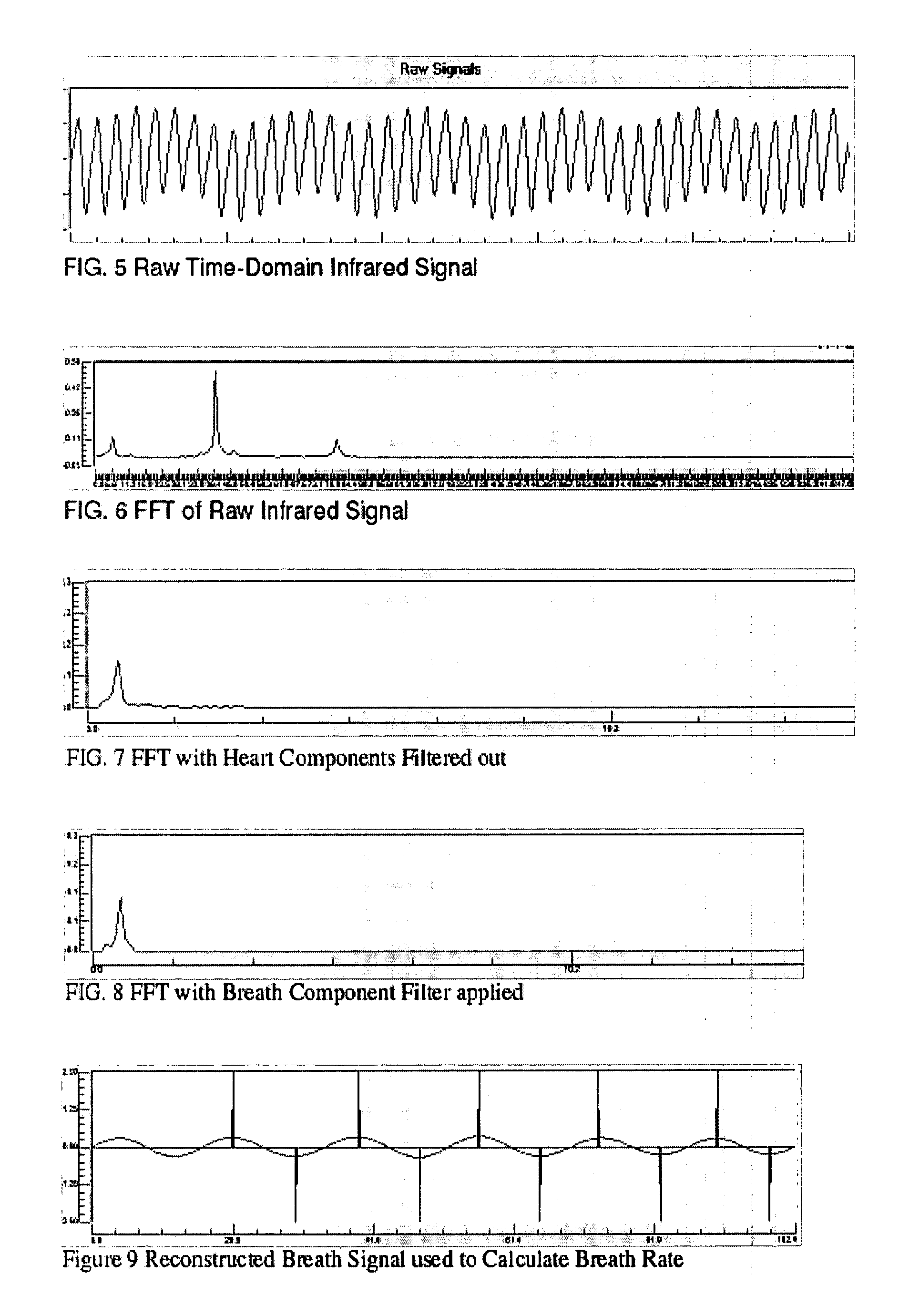 Pulse oximeter based techniques for controlling anesthesia levels and ventilation levels in subjects