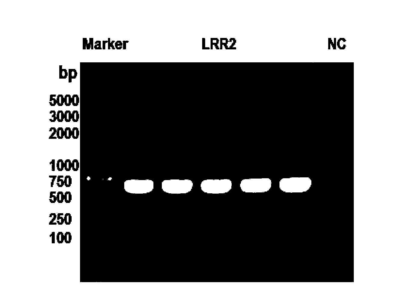 Fusion protein containing leucine-rich repetitive sequence, and preparation method and application thereof