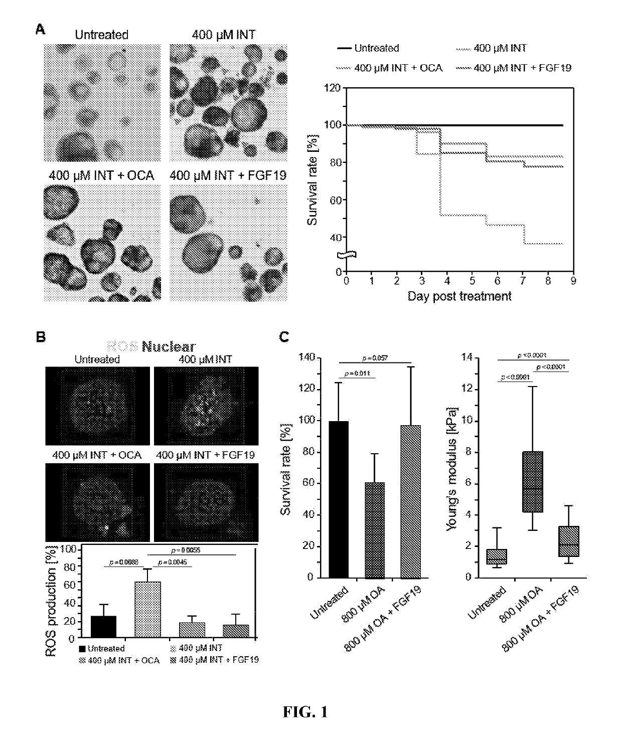 Compositions and methods of treating liver disease