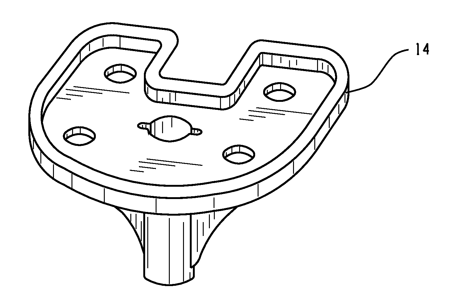 Method of Designing Orthopedic Implants Using In Vivo Data