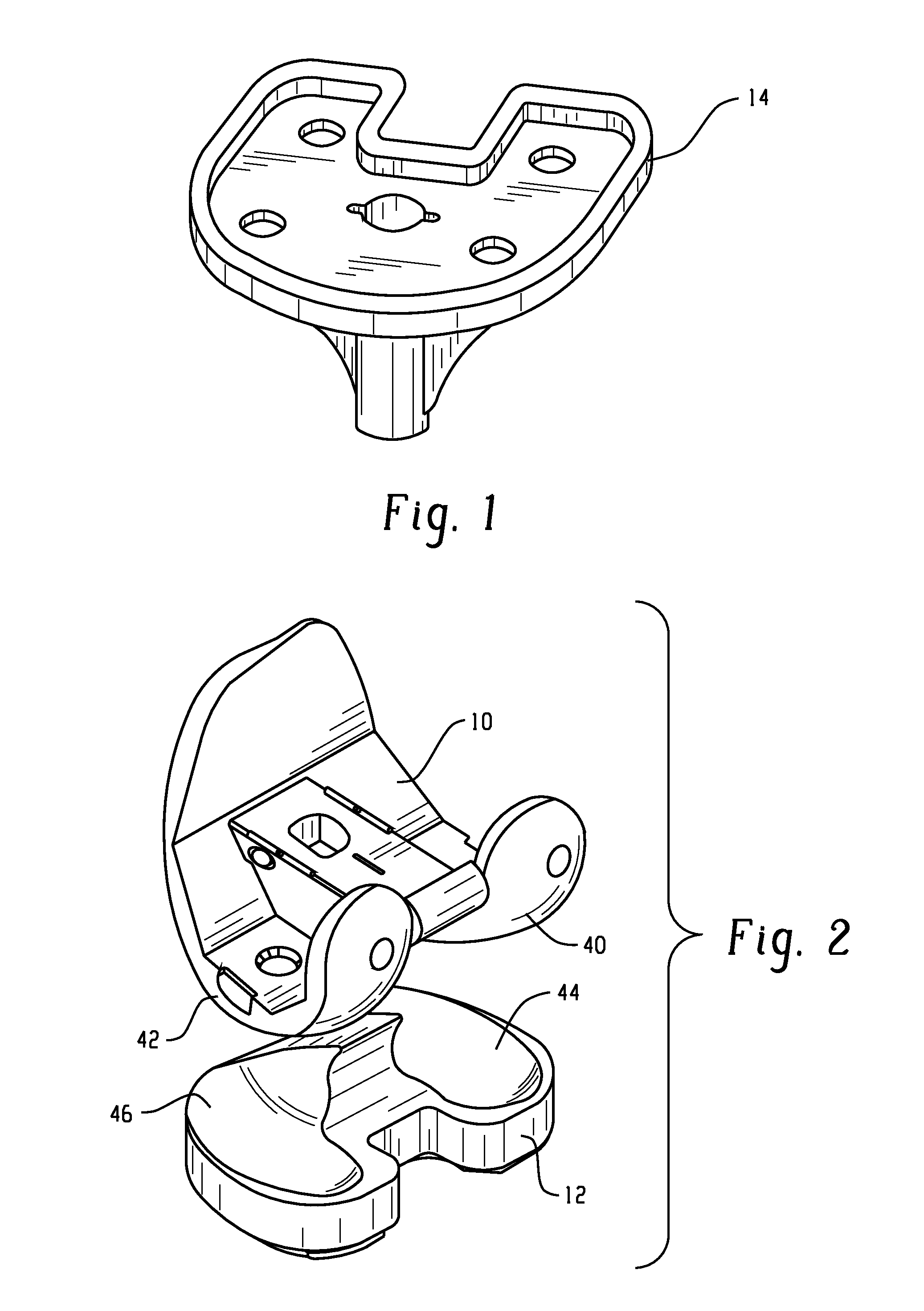 Method of Designing Orthopedic Implants Using In Vivo Data