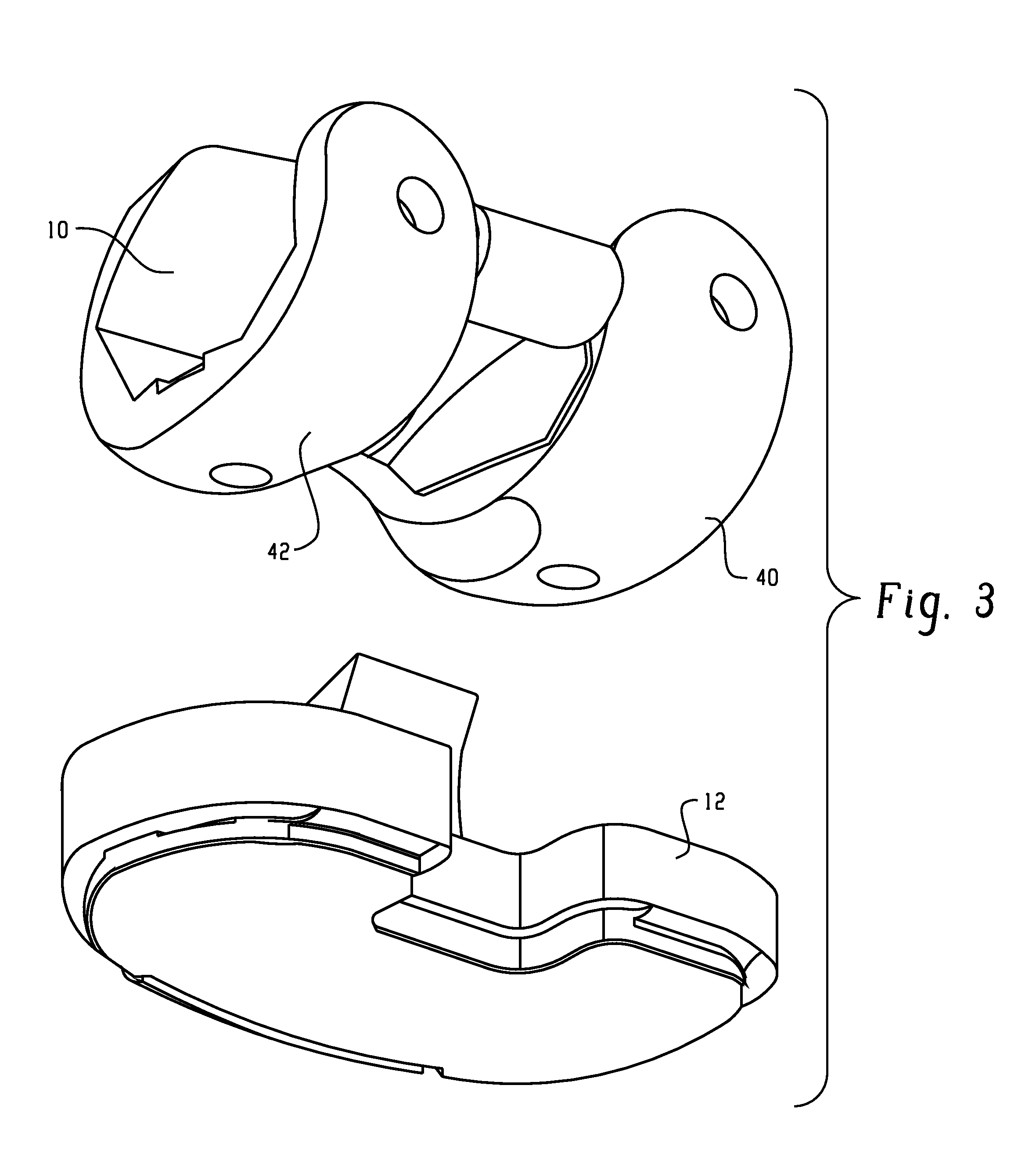 Method of Designing Orthopedic Implants Using In Vivo Data