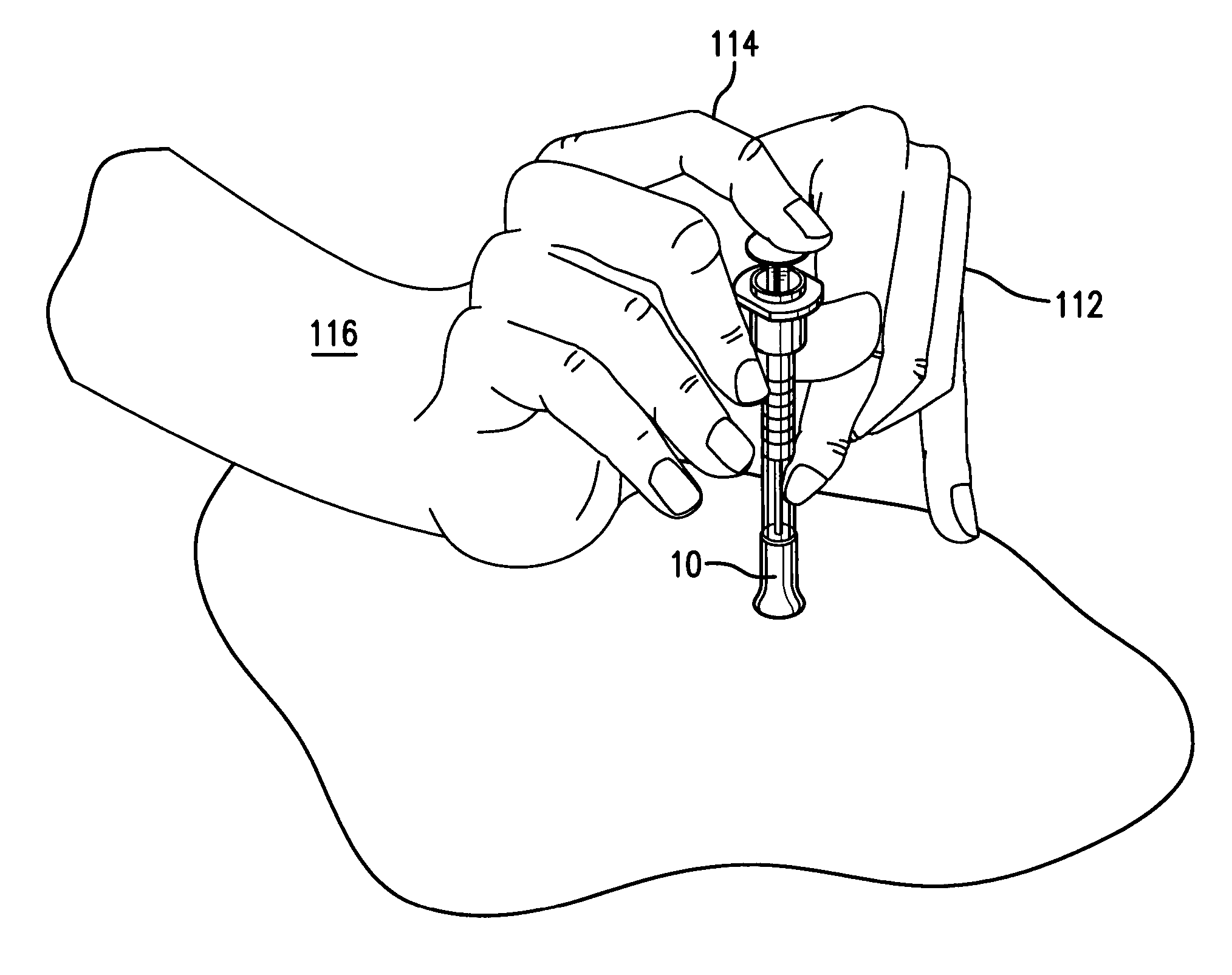 Methods and devices for improving delivery of a substance to skin