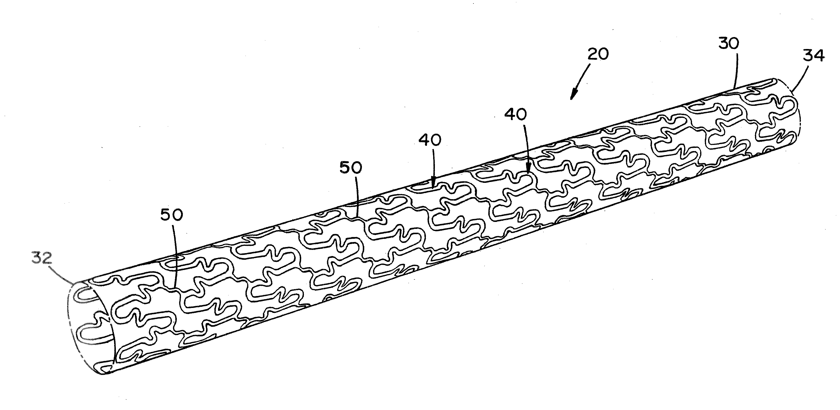 Stent