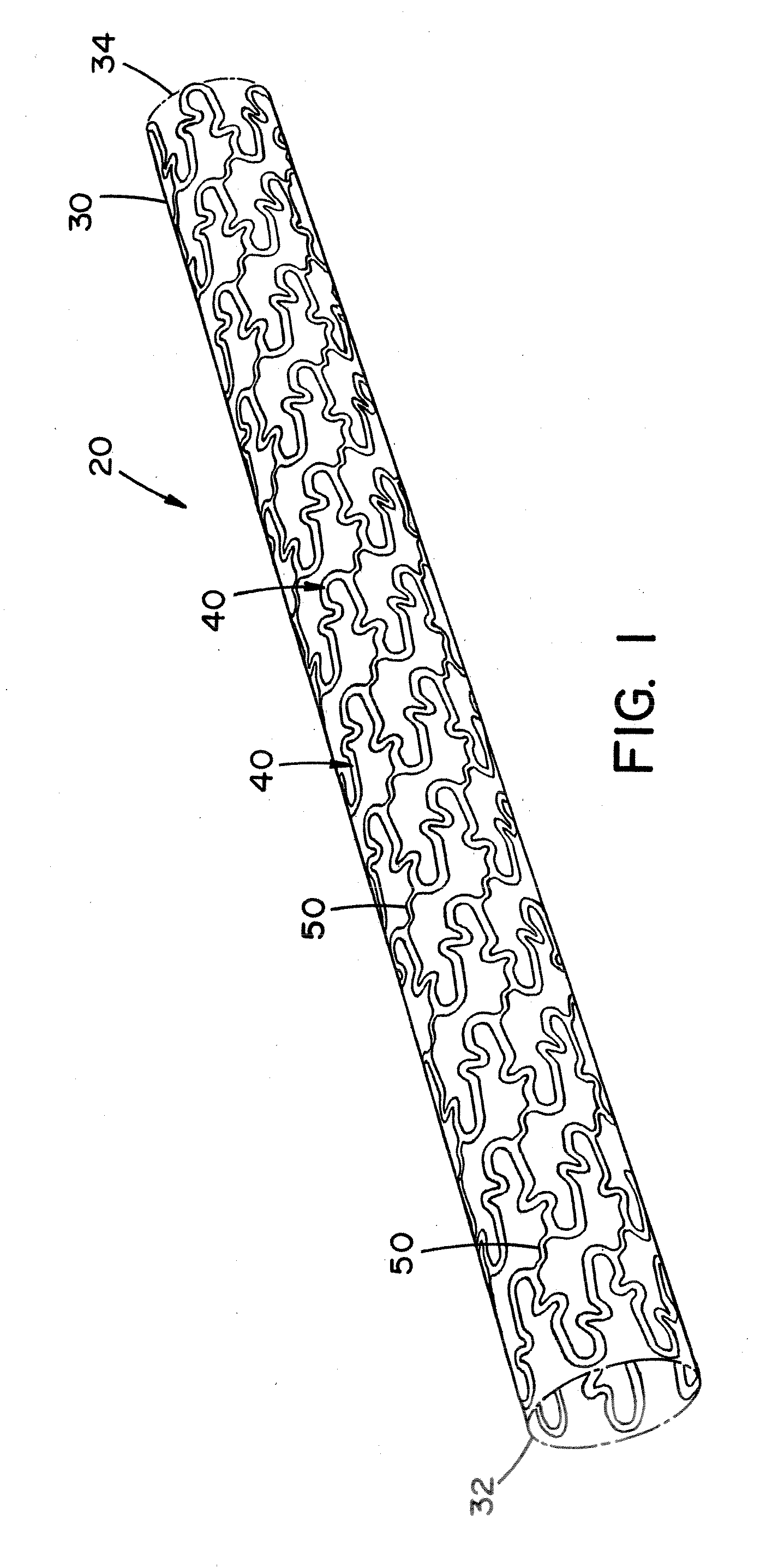 Stent